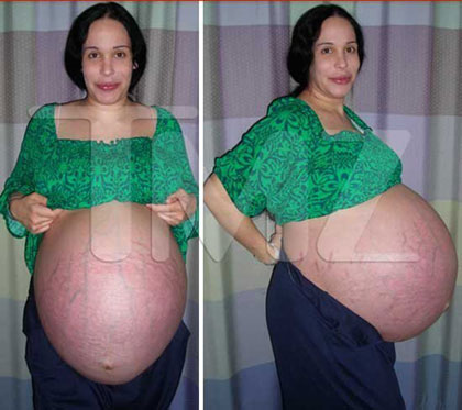 fotos de bebes en el vientre. ocho ebés en su vientre.